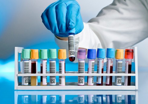 Azərbaycanın daha üç idmançısı antidopinq pozuntusuna görə cəzalandırılıb