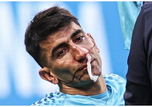 İran millisinin qapıçısı üçün mundial başa çatıb